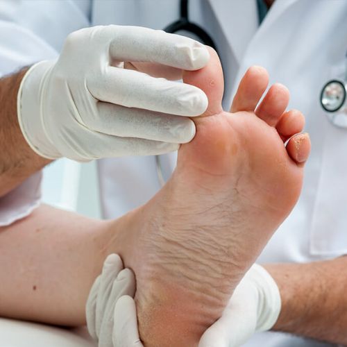 Mobile Foot Care Sydney